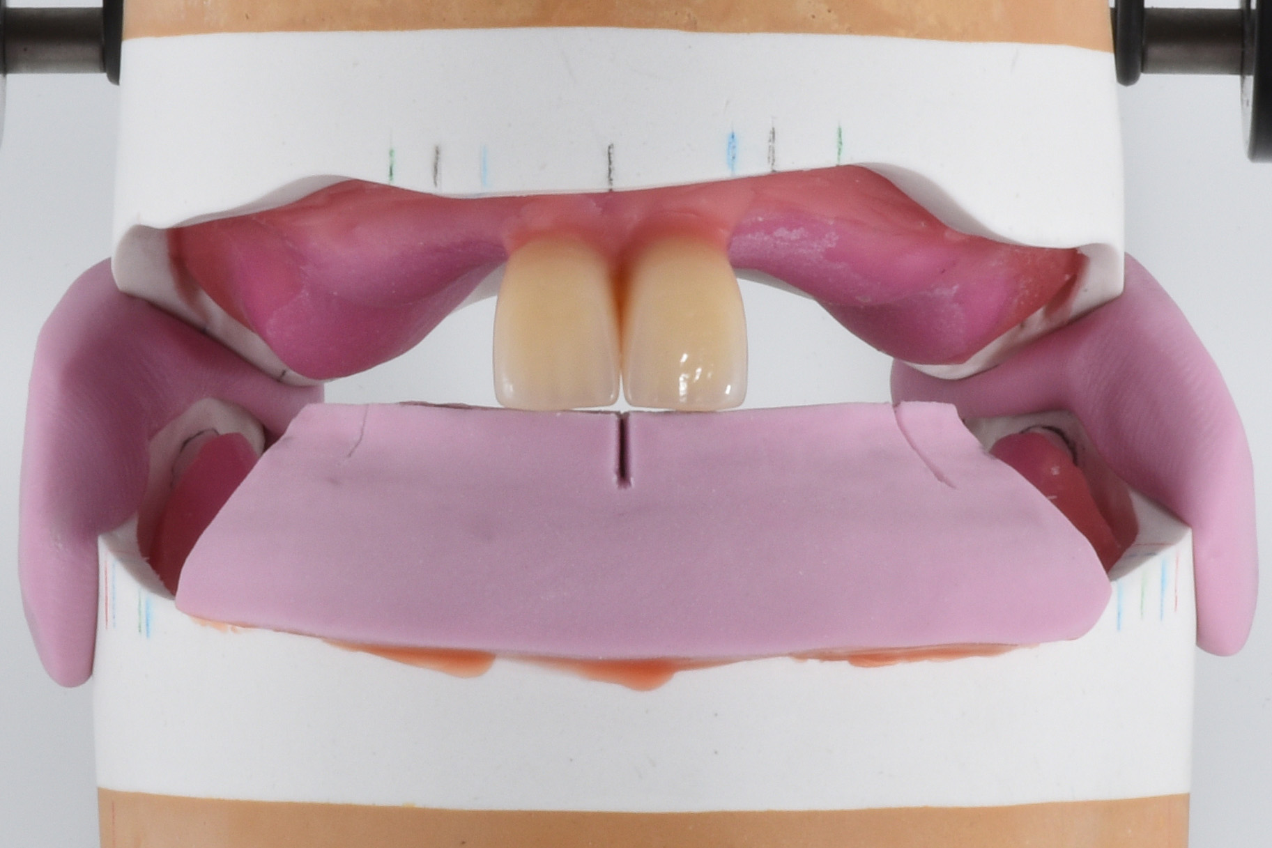 健康・医学 Best Denture Design Design high quality dentures using exocad by Dentcadsl | Fiverr